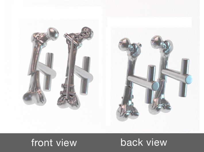 Femur Fracture and Fixation Cufflinks 3d printed Digital render of cufflinks in polished silver