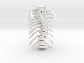 Thoracic Spine - Scoliosis (SKU 006) in White Natural Versatile Plastic