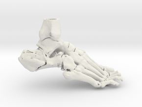 Foot and Ankle - Calcaneal Fracture (SKU 011) in White Natural Versatile Plastic