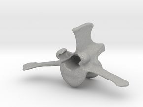 Lumbar Vertebra in Aluminum