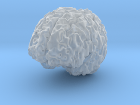 Brain MRI in Clear Ultra Fine Detail Plastic