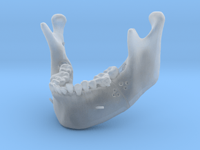 Subject 2a | Mandible (Before IMDO) in Clear Ultra Fine Detail Plastic