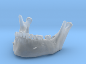 Subject 2o | Mandible (After IMDO) in Clear Ultra Fine Detail Plastic