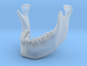 Subject 3a | Mandible (Before) in Clear Ultra Fine Detail Plastic