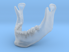 Subject 3b | Mandible (After) in Clear Ultra Fine Detail Plastic