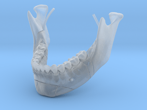 Subject 1a |  Mandible in Clear Ultra Fine Detail Plastic