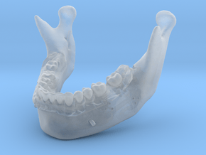 Subject 0.h | Mandible (After) in Clear Ultra Fine Detail Plastic