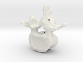 L3 lumbar vertebral body in White Natural Versatile Plastic