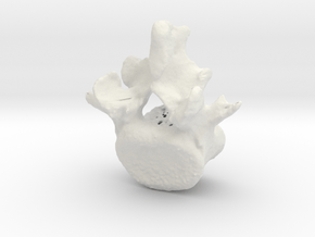 L5 lumbar vertebral body in White Natural Versatile Plastic