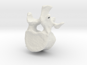 L1 lumbar vertebral body in White Natural Versatile Plastic