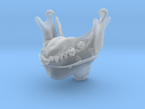 Subject 2l | Mandible + Tongue + Distractors (Afte in Tan Fine Detail Plastic