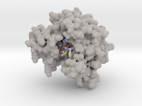 New Delhi Metallo Beta-Lactamase (NDM-1) in Natural Full Color Sandstone