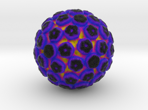 JC Polyomavirus in Full Color Sandstone