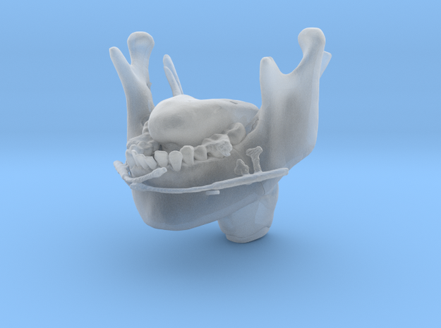 Subject 2d | Mandible + Tongue + Distractors (Befo in Tan Fine Detail Plastic