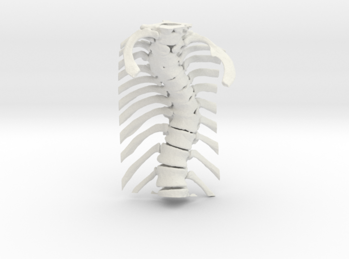 Thoracic Spine - Scoliosis (SKU 006) 3d printed