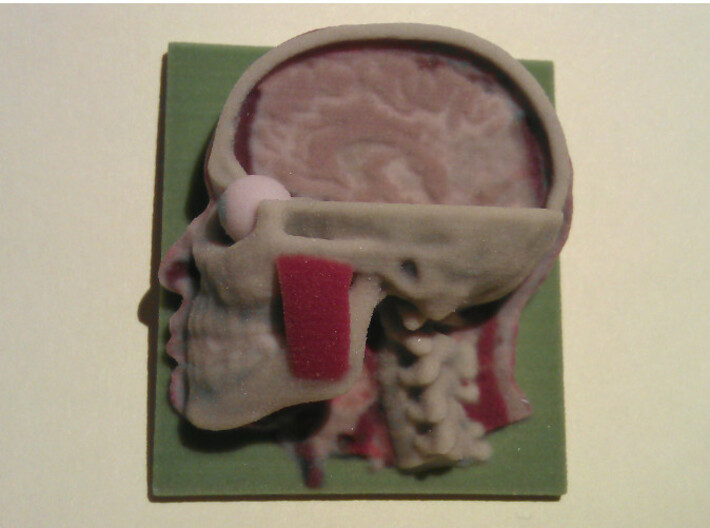 Human Head Section 3d printed 