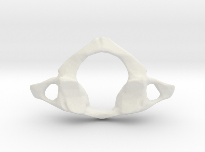 First Cervical Neck Vertebra - Atlas 3d printed