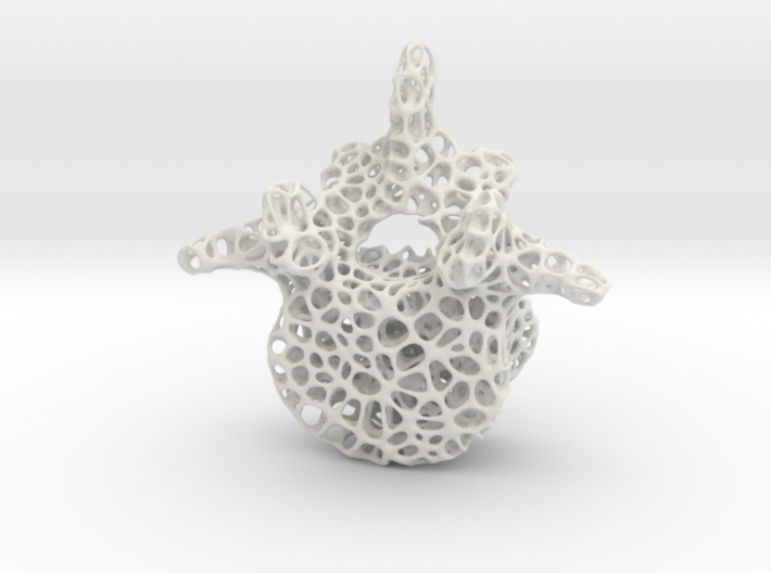 Voronoi Spine L4 bone 3d printed 