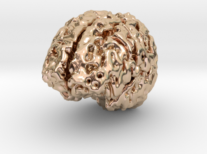 Brain MRI 3d printed