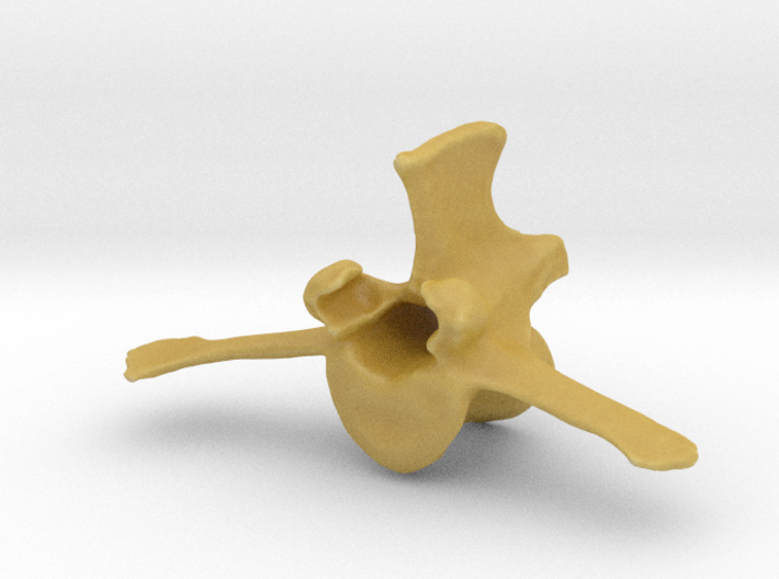 Lumbar Vertebra 3d printed