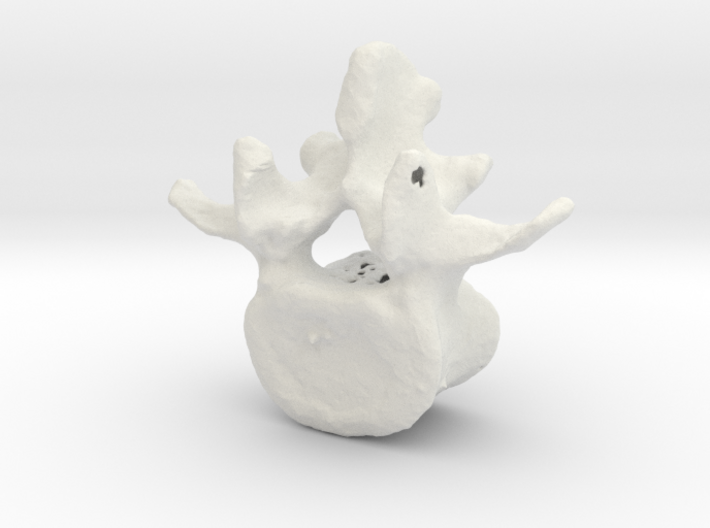 L4 lumbar vertebral body 3d printed