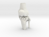 Knee - Proximal Tibia Fracture (SKU 005) 3d printed 