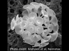 Discosphaera Coccolithophore earrings 3d printed Micrograph of Discosphaera
