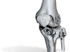 Knee - Proximal Tibia Fracture (Tibial Plateau) 3d printed 