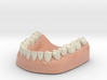 3D Teeth lower 3d printed 