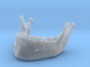 Subject 2o | Mandible (After IMDO) 3d printed 